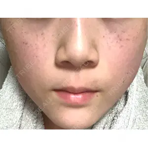 L‘amour clinic Tokyo【ラムールクリニック東京】口コミ