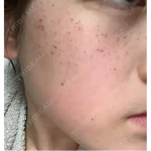 L‘amour clinic Tokyo【ラムールクリニック東京】口コミ