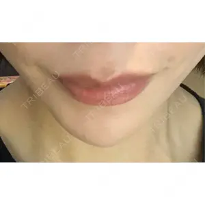 HAAB×DREAM BEAUTY CLINIC 東京本院の