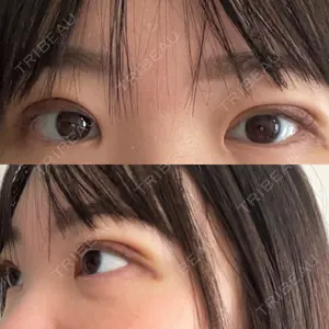 藤・ナチュレ美容クリニック 藤・ナチュレ美容クリニック 銀座院口コミ