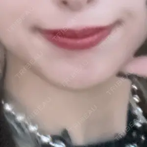 PRISM Beauty Clinic  PRISM Beauty Clinic 町田院口コミ