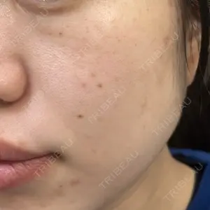 ルラ美容クリニック ルラ美容クリニック 新宿院口コミ