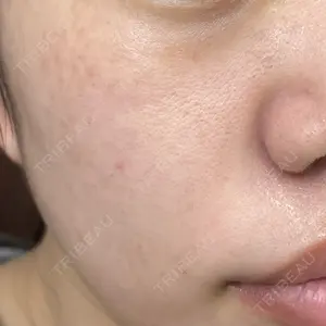 ルラ美容クリニック ルラ美容クリニック 新宿院口コミ