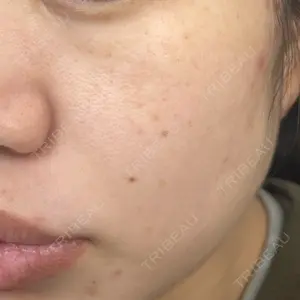 ルラ美容クリニック ルラ美容クリニック 新宿院口コミ