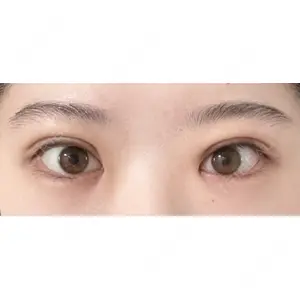 湘南美容クリニック 湘南美容クリニック 池袋東口院口コミ