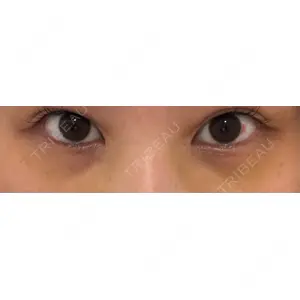 APOLLO BEAUTY CLINIC口コミ