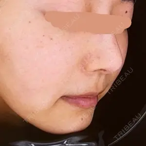 ハナビューティークリニック口コミ