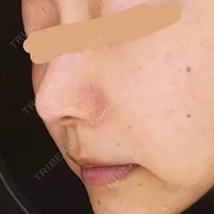 ハナビューティークリニック口コミ