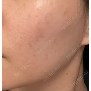 ハナビューティークリニック口コミ