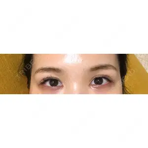 HAAB×DREAM BEAUTY CLINIC HAAB×DREAM BEAUTY CLINIC 大阪梅田院口コミ