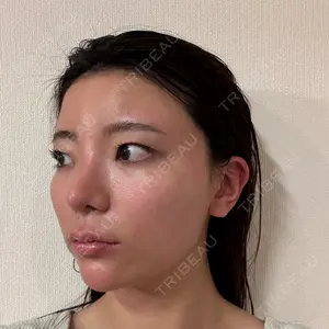 ASTRA BEAUTY CLINIC口コミ
