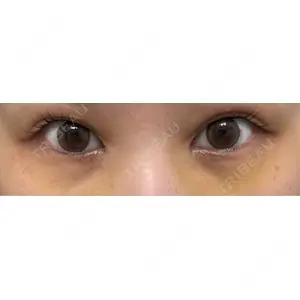 APOLLO BEAUTY CLINIC口コミ