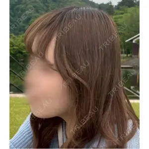 AYANAフィラーズクリニック AYANAフィラーズクリニック 渋谷院口コミ