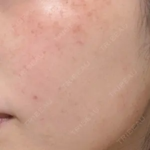 麹町皮ふ科・形成外科クリニック口コミ