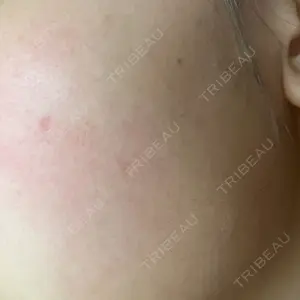 プライベートスキンクリニック 梅田本院口コミ