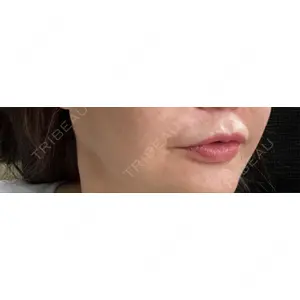 APスキンクリニック銀座口コミ