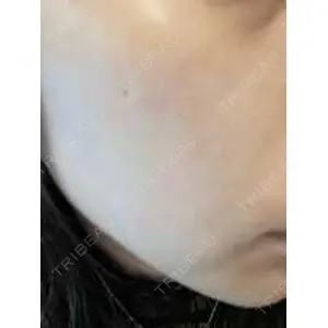 ルラ美容クリニック ルラ美容クリニック 池袋院口コミ