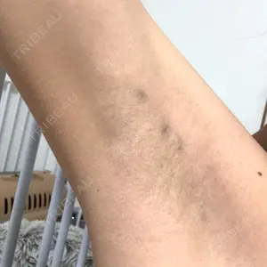 フォンタナクリニック天神口コミ
