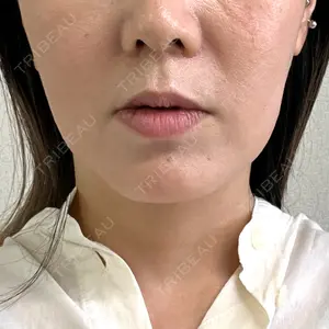 口コミ