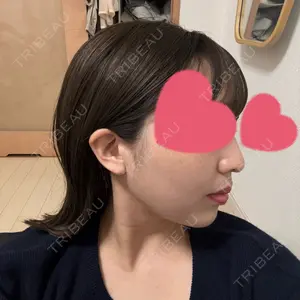 脂肪吸引ラボトウキョウ口コミ