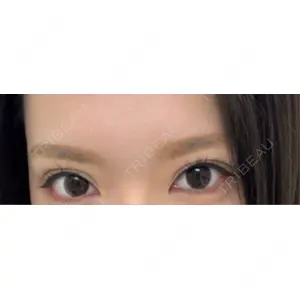 口コミ