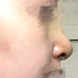 X CLINIC X CLINIC 大阪院口コミ