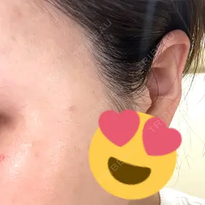 APスキンクリニック銀座口コミ