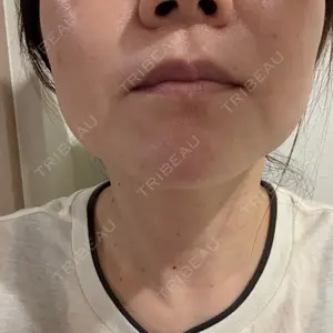 口コミ