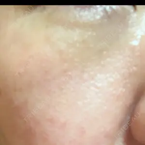 APスキンクリニック銀座口コミ