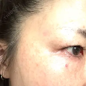 APスキンクリニック銀座口コミ