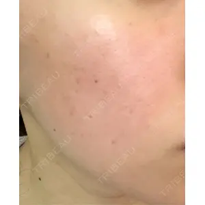 L‘amour clinic Tokyo【ラムールクリニック東京】口コミ