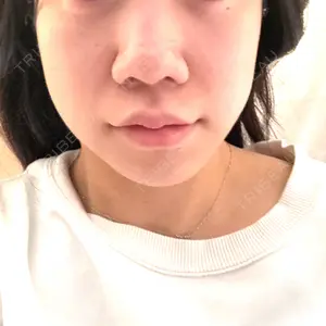口コミ