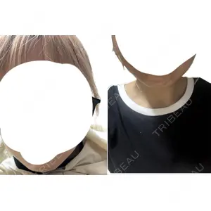 TCB東京中央美容外科 TCB東京中央美容外科 宇都宮院口コミ