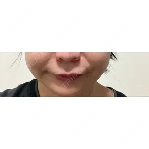 APスキンクリニック銀座口コミ