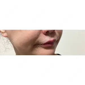 APスキンクリニック銀座口コミ