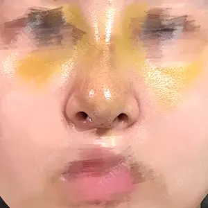 X CLINIC X CLINIC 大阪院口コミ