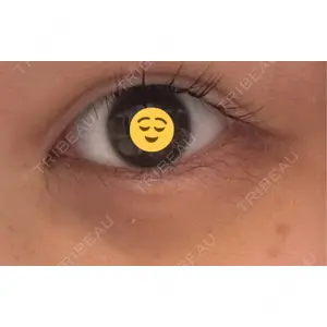 APOLLO BEAUTY CLINIC口コミ