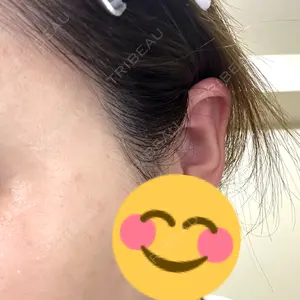 APスキンクリニック銀座口コミ