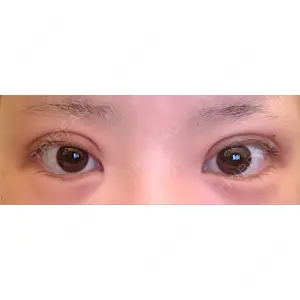 PRO CLINIC プロクリニック 銀座院口コミ
