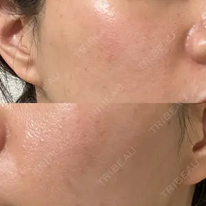 ハナビューティークリニック口コミ