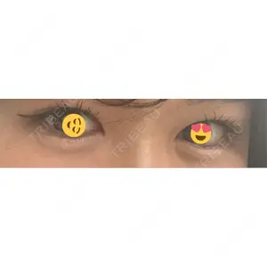 LUHO（ルホ）美容外科口コミ