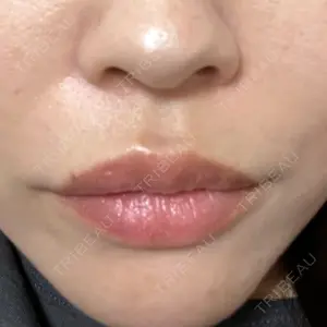 ルラ美容クリニック ルラ美容クリニック 名古屋栄院 / ルラスキンクリニック 名古屋栄院口コミ