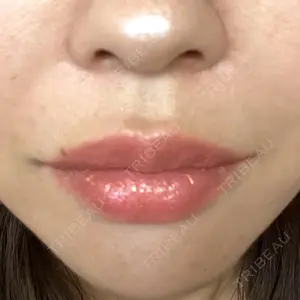 ルラ美容クリニック ルラ美容クリニック 名古屋栄院 / ルラスキンクリニック 名古屋栄院口コミ