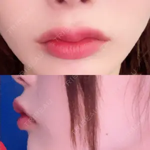 PRO CLINIC プロクリニック 銀座院口コミ