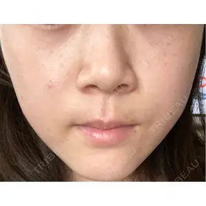 L‘amour clinic Tokyo【ラムールクリニック東京】口コミ