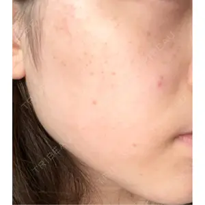 L‘amour clinic Tokyo【ラムールクリニック東京】口コミ