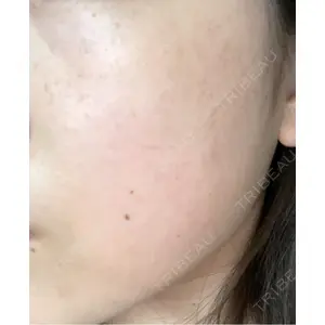 L‘amour clinic Tokyo【ラムールクリニック東京】口コミ