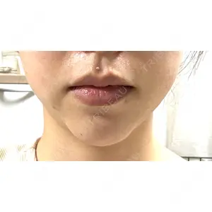 口コミ