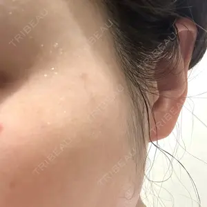 APスキンクリニック銀座口コミ