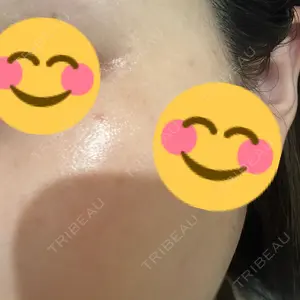 APスキンクリニック銀座口コミ